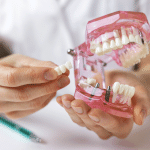 dentist implantologist showing dental bridge implant technology on human tooth jaw model.