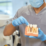 A dental doctor with a model of a dental implant in his hands