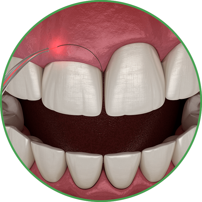 crown lengthening circle