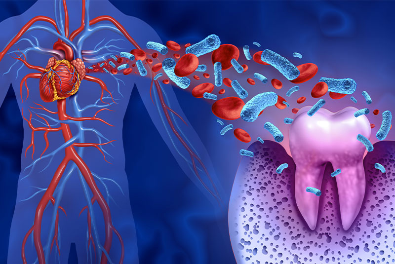 heart risk because of perio dark